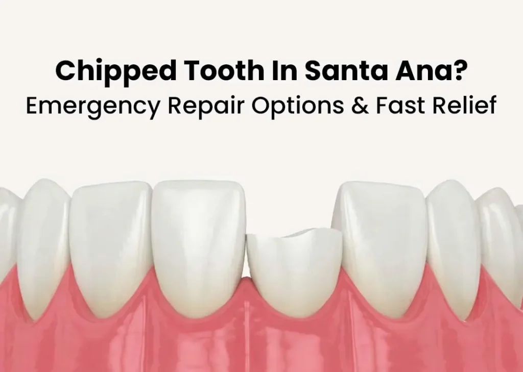 Chipped Tooth in Santa Ana Emergency Repair Options & Fast Relief