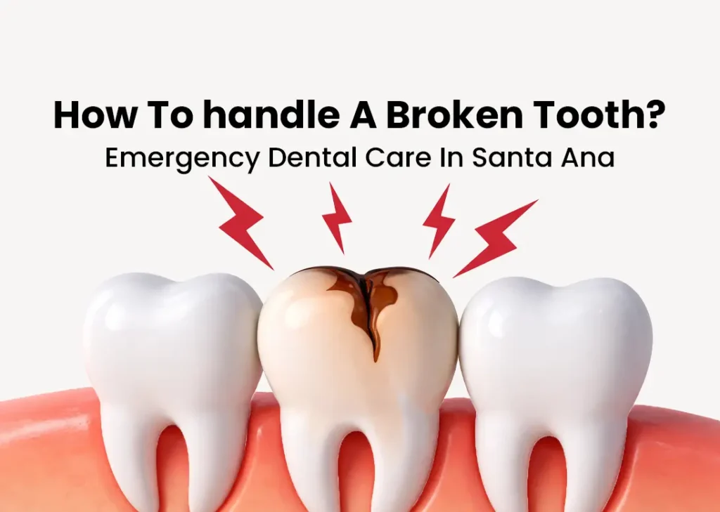 How To Handle a Broken Tooth Emergency in Santa Ana