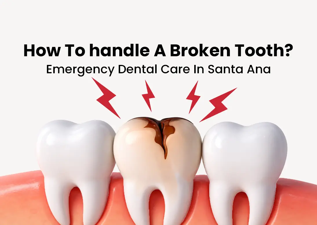 How To Handle a Broken Tooth Emergency in Santa Ana