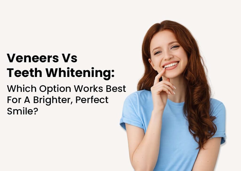 Veneers vs Teeth Whitening Which Option Works Best for a Brighter, Perfect Smile