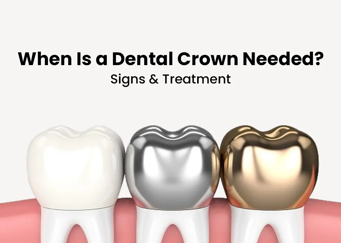 when is a dental crown needed signs and treatement