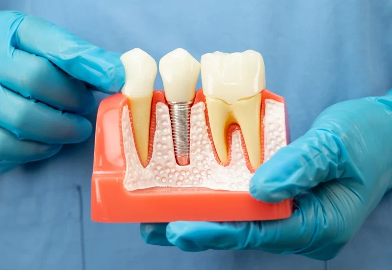 Routine-Pediatric-Dental-Checkups-Are-Important-for-Kids